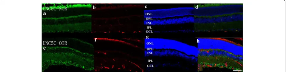 Figure 4 Double immunostaining of UNC5B with isolectin B4.outer nuclear layer. Bar = 50in OIR mice than in normal mice (( UNC5B is expressed in the ganglion cell layer, inner plexiform layer, and outerplexiform layer, and the expression of UNC5B is elevate