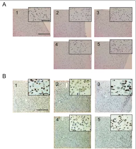 Figure 10 Immunohistochemical evaluation of the effect of CTS on aging-induced decrease in VEGF (A) and PDGF-A (B) in theprefrontal cortex region
