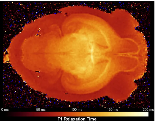 Figure 2 - T1 relaxation time map of a stained postnatal day 12 rat brain. When soaked in a 5  mM solution of gadolinium chelate for 5-7 days, the T1 of the brain parenchyma is approximately  80-130 ms