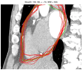 Figure 1.2: A sagittal slice of one of the atlases. By aligning the labels of several atlases (by estimating a transformation through registration) onto the target image we get a good estimate of the segmentation