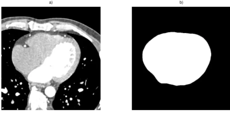 Figure 3.1: a) One slice of an CT-volume. b) Corresponding slice of the manual labeling