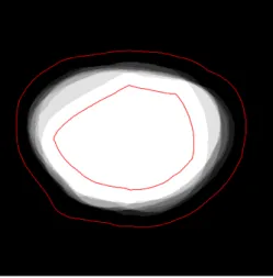 Figure 5.1: A slice of a vote map constructed from 9 rigid feature based atlas registrations