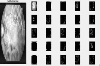Fig. 8. Post-processing steps involved in retina vessels segmentation. (a) Output of processing stage