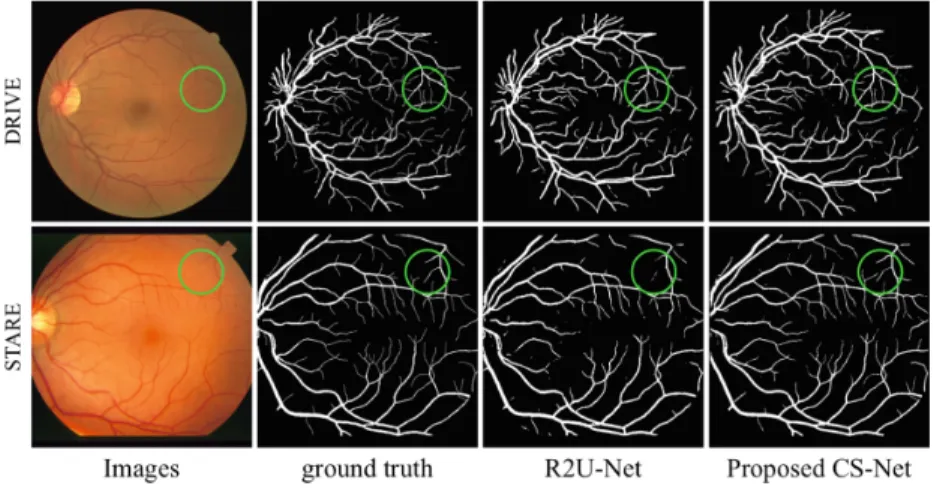 Fig. 2. Retinal vessel segmentation results for two randomly selected images by R2U- R2U-Net and our CS-R2U-Net.