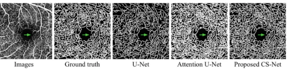Fig. 3. Visualization results of vessel segmentation in OCT-A.