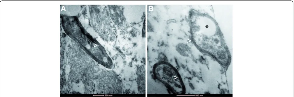 Fig. 5 Electron microscopy. Electron microscopy showing brain tissue with regularly myelinated axons (arrow heads, a + b)