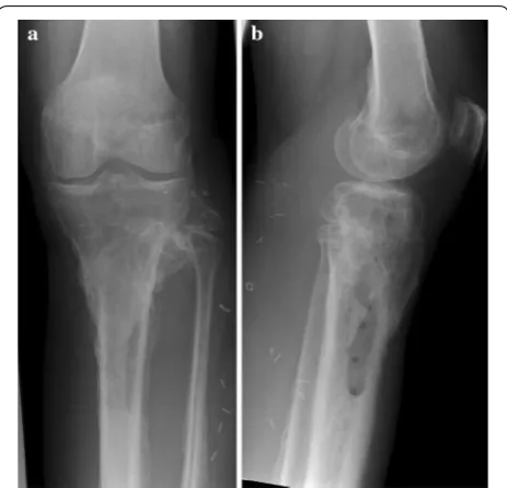 Fig. 9 Osseous consolidation 12 months after initial trauma. a X-ray a.p. view and b X-ray lateral view