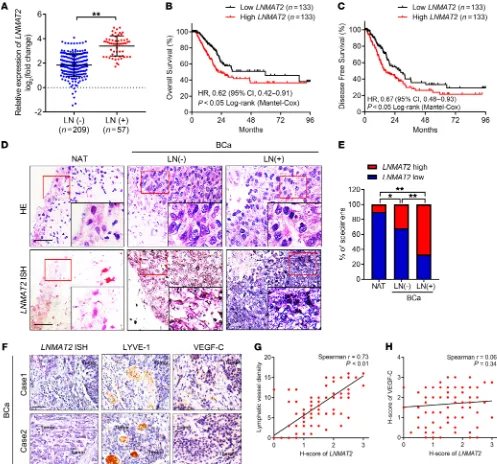 Figure 1. LNMAT2and and that  overexpression is associated with BCa lymphatic metastasis