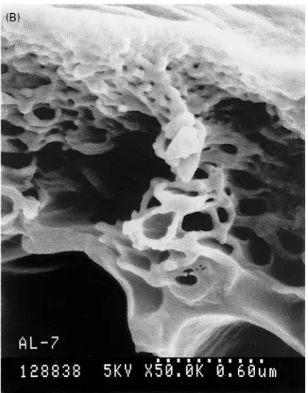 Figure 4(A) Porous bulk structure and (B) skin layer of anintegrally-skinned asymmetric polysulfone membrane made bythe immersion precipitation process.