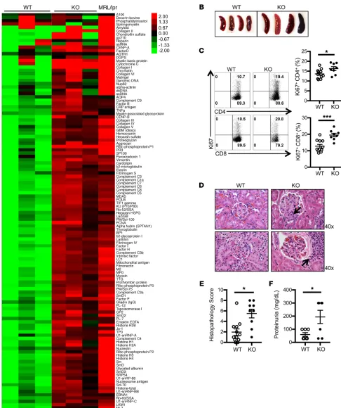 Figure 1. Srsf1-cKO mice develop systemic autoimmunity and lupus nephritis. (A) Heatmaps show autoantibody microarray data from sera of 12-week-old WT and Srsf1-cKO mice (n = 3 each) and 1 MRL/lpr mouse, analyzed for IgG reactivity against a 128-autoantige