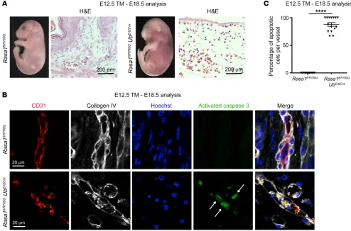 Figure 9. BV abnormalities in embryos induced to express RASA1 R780Q alone during developmental angiogenesis