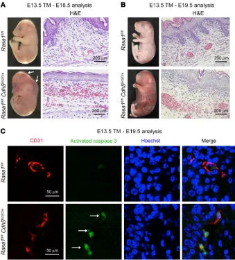 Figure 2. BV abnormalities following disruption of Band skin sections were stained with HNote the localized hemorrhage in Rasa1 specifically within ECs during developmental angiogenesis