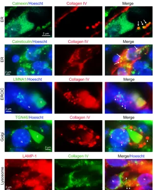 Figure 4. Collagen IV is trapped within the ER of BECs following disruption of Rasa1 during developmental 