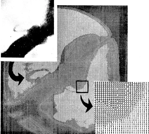 Figure lc. out one of the from section At the upper left is a section of an original picture of an angiogram, or x-ray heart, after radio-opaque dye had been injected into the blood
