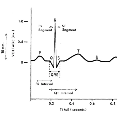 Figure 3 between a number data. The vector scheme involves a and accepted. Both systems involve sending tion of simultaneous ECG ECG time and calibra-correlation diagramming complexes, intervals