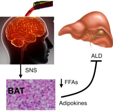 Figure 8. Protection against ALD by brain/SNS/BAT axis. Brain alcohol- sensing activates BAT through increasing sympathetic inputs