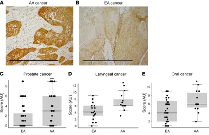 Figure 4. Tissue microarray analysis shows increased mitochondria in samples from African American patients