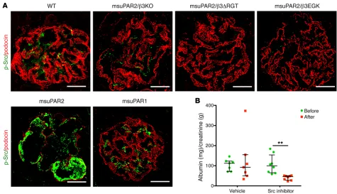 Figure 7. Blocking Src activity reduces proteinuria in msuPAR2-Tg mice. (A) Glomerular Src activity was determined by immunofluorescent staining of the kidney cryosections with p-Src monoclonal antibody (green)