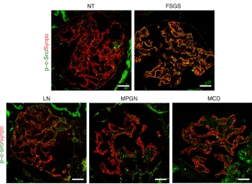 Figure 8. Glomerular c-Src activity is increased in human FSGS kidney. Immunofluorescent staining with p–c-Src antibody was performed for the frozen sections of deidentified human kidney biopsies