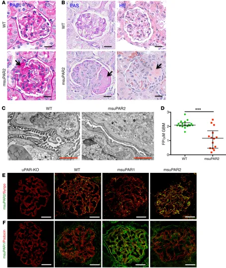 Figure 4. msuPAR2-Tg mice present FSGS-like kidney pathology. (A) PAS staining of kidney sections from spontaneous non–HFD treated mice