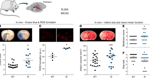 Figure 3. NOX5 leads to increased stroke size and BBB damage and aggravates neuromotor function