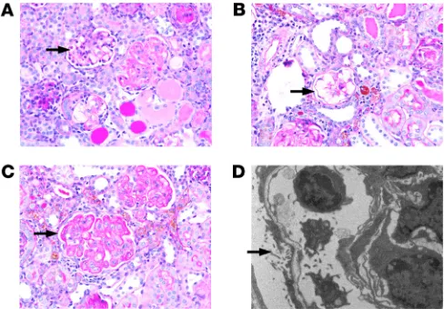 Figure 4. TMA in C3KI mice. PAS-stained sections from C3KI mice aged 14–28 days. Images are representative of the 8 C3KI mice examined