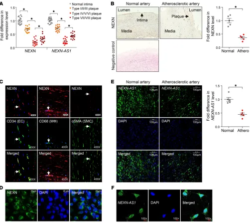 Figure 1. Expression of NEXN and NEXN-AS1 in atherosclerotic plaques. (A) NEXN and NEXN-AS1 expression levels in human normal and athero-sclerotic arteries, quantified by RT-PCR