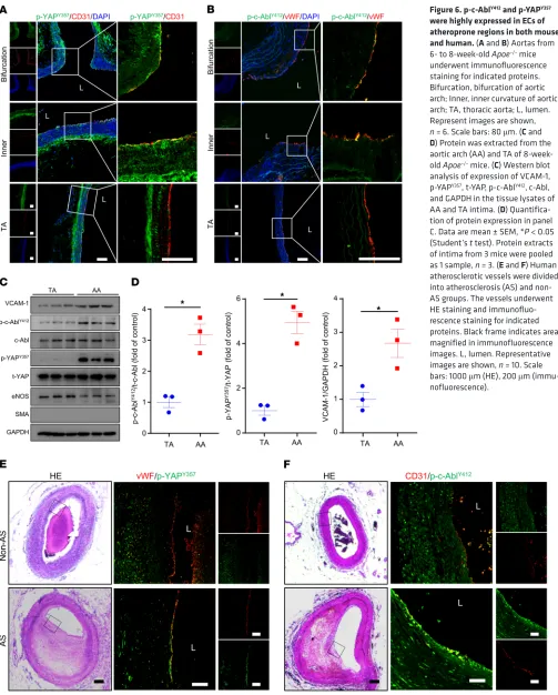 Figure 6. p-c-AblY412 and p-YAPY357 were highly expressed in ECs of 