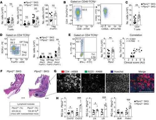 Figure 3. Increased accumulation of synovial Th17 cells and ELSs in Ptpn2correlation) of male ulations Th1 and Th17 (0.015, Fisher’s exact test)