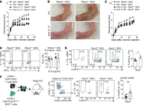 Figure 6. IL-6 promotes arthritis and Treg conversion in Ptpn2during mannan-induced arthritis