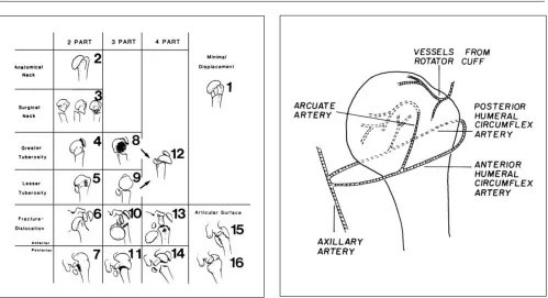 Fig. 1 Neer’s four-part classification (from [2] with permission)