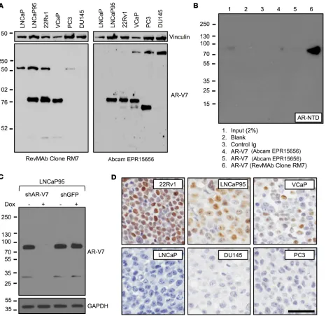Figure 1. Validation and optimization of a potentially novel AR-V7 antibody (Clone RM7) for immunohistochemistry