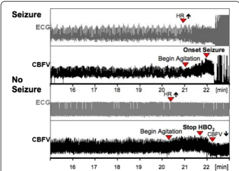 Fig. 2 Original recordings of ECG and cerebral blood flow velocity paneland a subsequent marked increase in CBFV