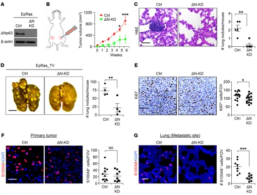 Figure 4. ΔNp63 promotes tumor growth, progression, and metastasis in mouse TNBC. (A) Western blot shows ΔNp63 (ΔN) protein expression in EpRas cells after shRNA lentivirus vector–mediated knockdown (KD)