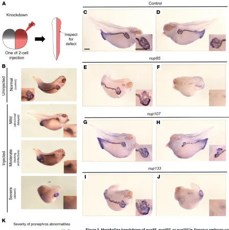 Figure 3. Morpholino knockdown of nup85ment, specifically improper formation of the convoluted pronephric duct, were scored at stages 35–37