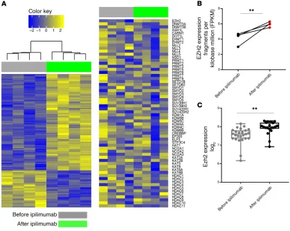 Figure 2. Ipilimumab increases EZH2 expression in T cells. (sion before and after ipilimumab therapy