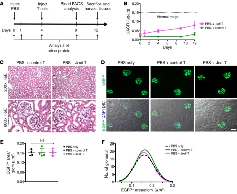Figure 1. Effects of Jedi T cell injections on normal pod-EGFP mice. (nEGFPA) Time course for the experimental protocol