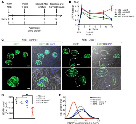 Figure 2. Effects of Jedi T cell injections in the setting of NTSN. (initially in all groups, but slowly declined over time in all groups, with the exception of the NTS plus Jedi T cell group