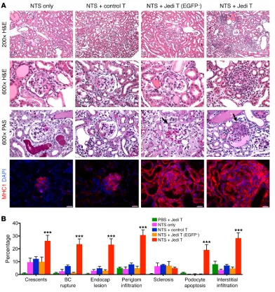 Figure 3. Histopathological analysis of mouse kidneys. (A) Representative images of H&E- and PAS-stained kidneys from mice injected with NTS