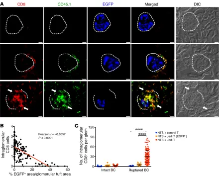 Figure 4. Effects of BC rupture on CD8/Jedi T cell infiltrations of glomerular space and EGFP+for all CD8images show costaining of Jedi CD45.1 podocytes