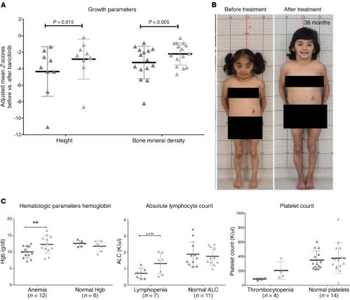 Figure 4. Improvement in longitudinal growth and hematologic parameters. (A) Clinically significant improvement was seen in height Z-scores and the percentiles of patients with growth potential (n = 13) when comparing data from before baricitinib treatment