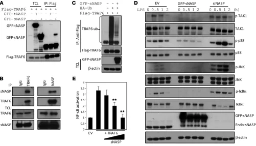 Figure 1. sNASP inhibits TLR4-induced NF-κB activation through TRAF6. (A) Immunoprecipitation (IP) of Flag-TRAF6 (with anti-Flag agarose) from HEK293 cells transiently transfected with Flag-TRAF6 plus GFP-tNASP (+), GFP-tNASP (+), or empty vector (–), foll