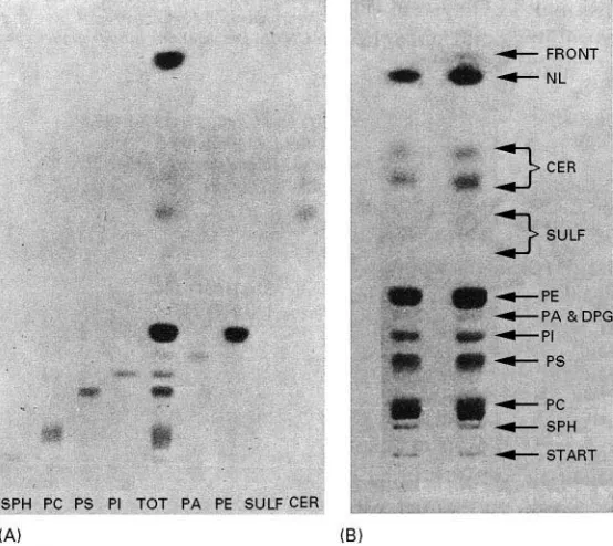 Figure 1Chromatograms of standard lipids in the solvent methyl acetate(25 : 25 : 25 : 10 : 9)