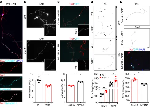 Figure 2. Pkn1swellings colocalized with the presynaptic marker synapsin I (images were taken at DIV4 and are representative of at least 3 separate experiments in WT and tcontrol HA-plasmid (Co-HA) or human HA-tagged Cgcs [2-tailed unpaired –/– Cgcs have a