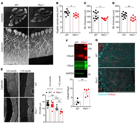 Figure 6. Adult Pkn1IGL thickness (ML thickness (by experimenters blinded to the genotype, except VGlut2-stained cerebellar sections of 3- to 9-month-old animals (representative images of 11–12 experiments; see Supplemental Figure 6C for analysis)