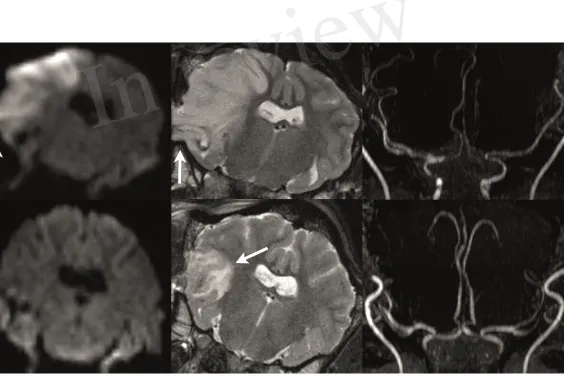 Figure 3.TIF