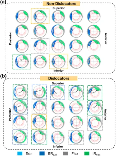 FIGURE 8.2D Graphical representation of the 3D hip motion considered in ‘Set 2’ of ‘Scenario-I’ for each (a) ‘Non-Dislocators’