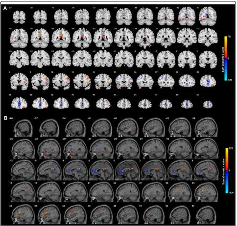Fig. 1 Anatomical location of voxels with signiﬁ0.05.) The right of the brain is on the right of each slice