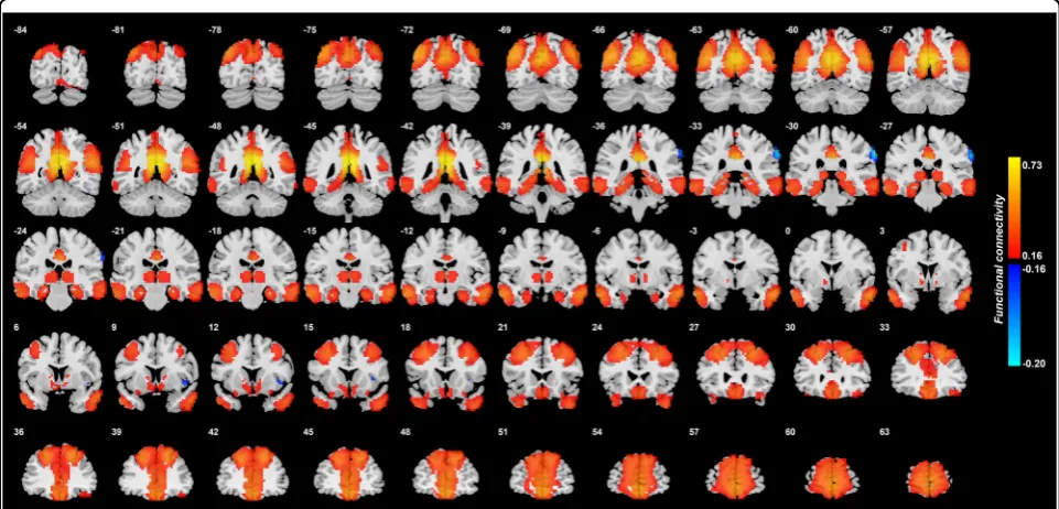 Fig. 2 Functional connectivity of the posterior cingulate cortex in 350 healthy controls