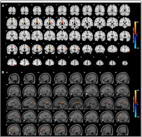 Fig. 3 Anatomical location of voxels with signiﬁsignicoordinates. This shows that the main differences are an increase in functional connectivity between the PCC and the lateral orbitofrontal cortex indifferent links to a voxel to be illustrated